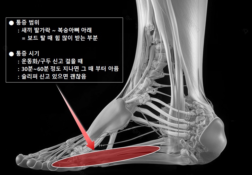 통증 위치.jpg