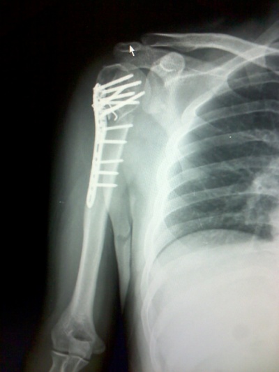 p110304_000.jpg
