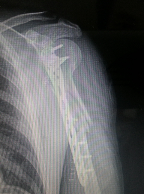 re20140227_100857.jpg