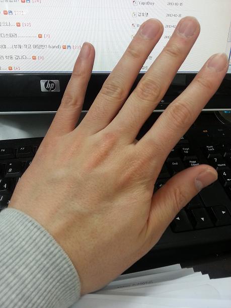 hand.JPG
