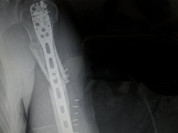 ree20140227_100729.jpg