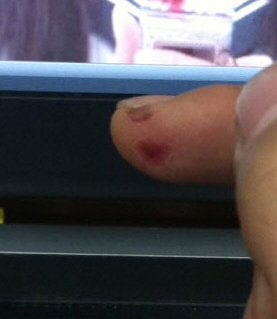 finger.jpg