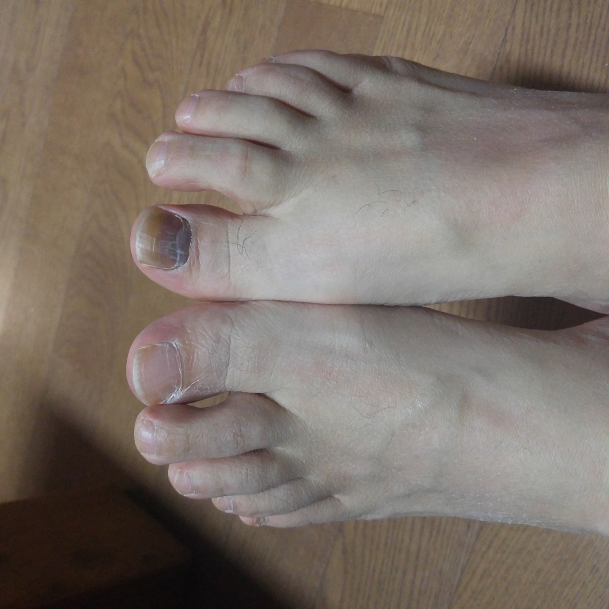 20161120_193437.jpg