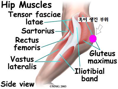 hip_anatomy_muscles.JPG